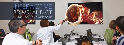 BodyViz Software License Stereoscopic for Entry-level projectors
